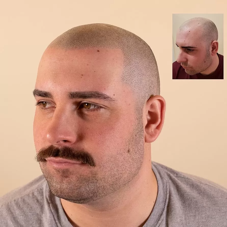 buzz cut receding hairline