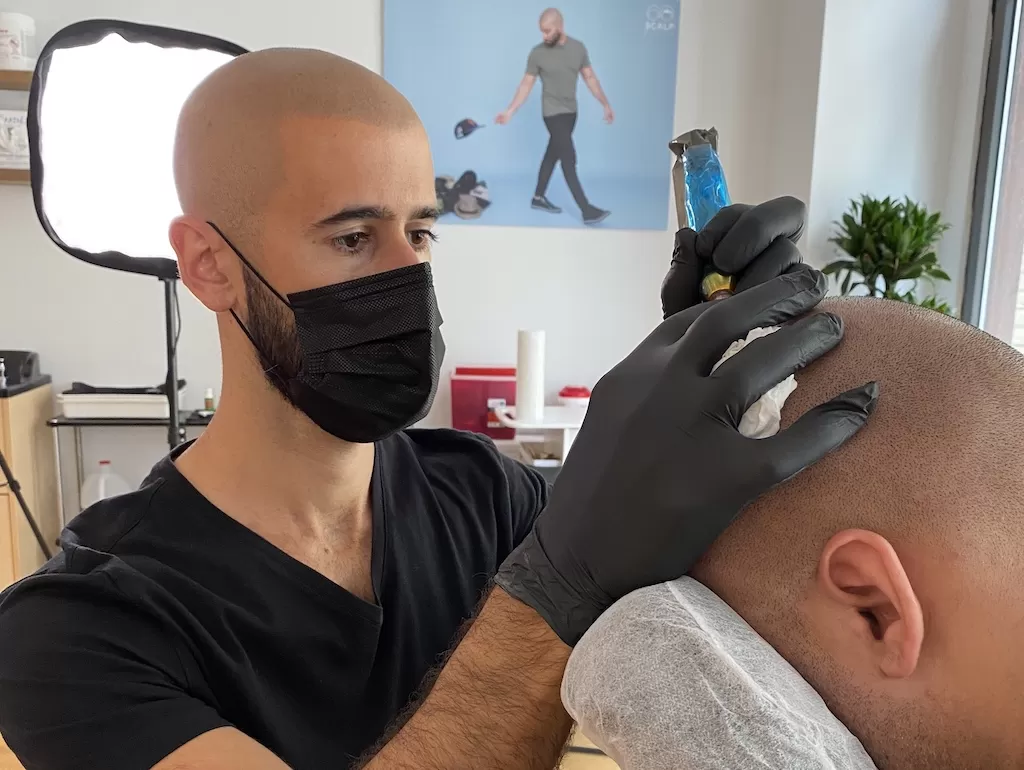 scalp micropigmentation nyc houston los angeles