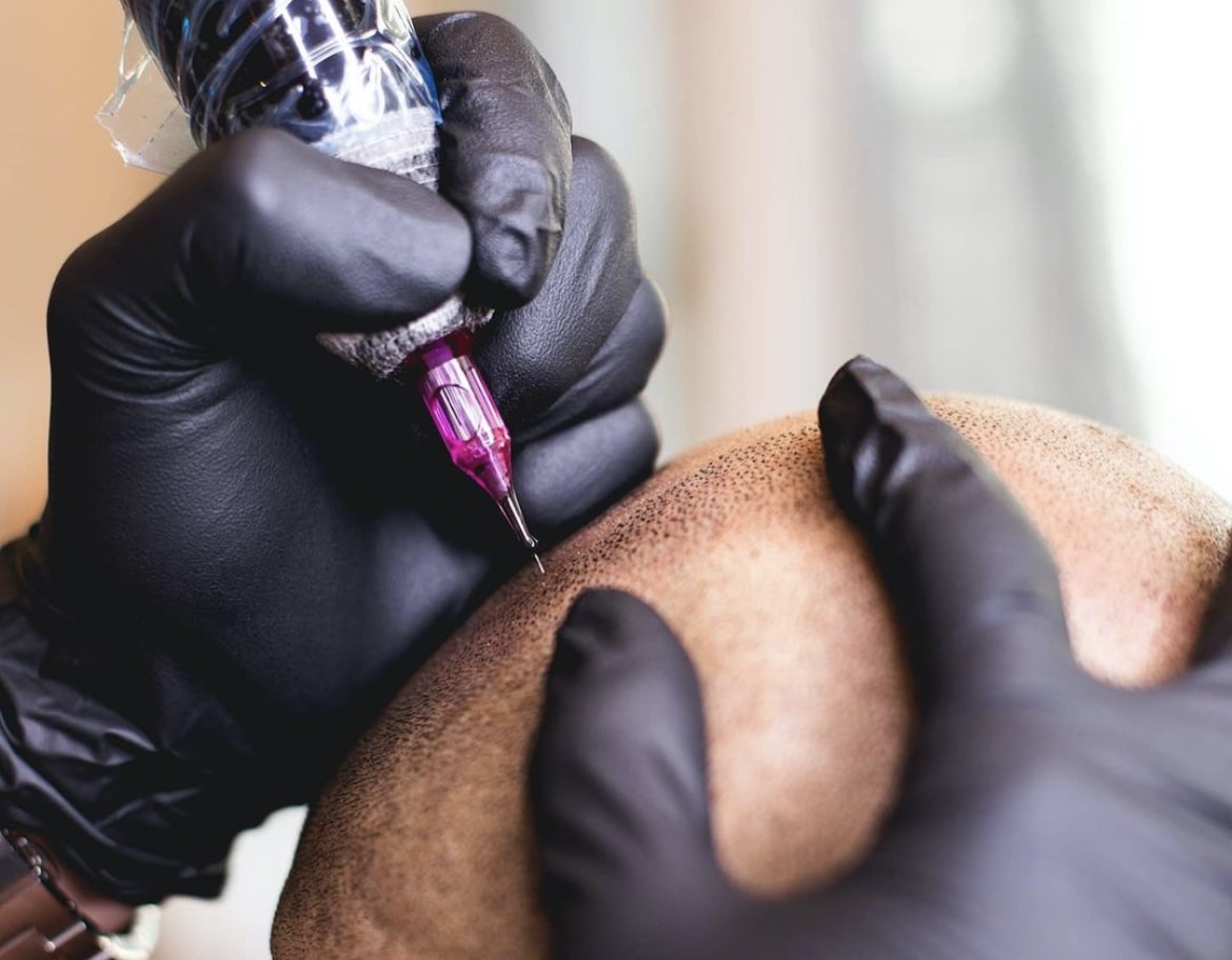 is scalp micropigmentation a tattoo
