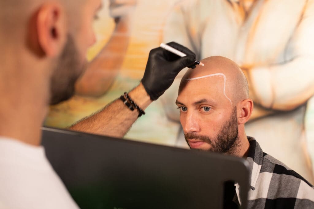 Scalp Micropigmentation Treatment Scalp Micro USA