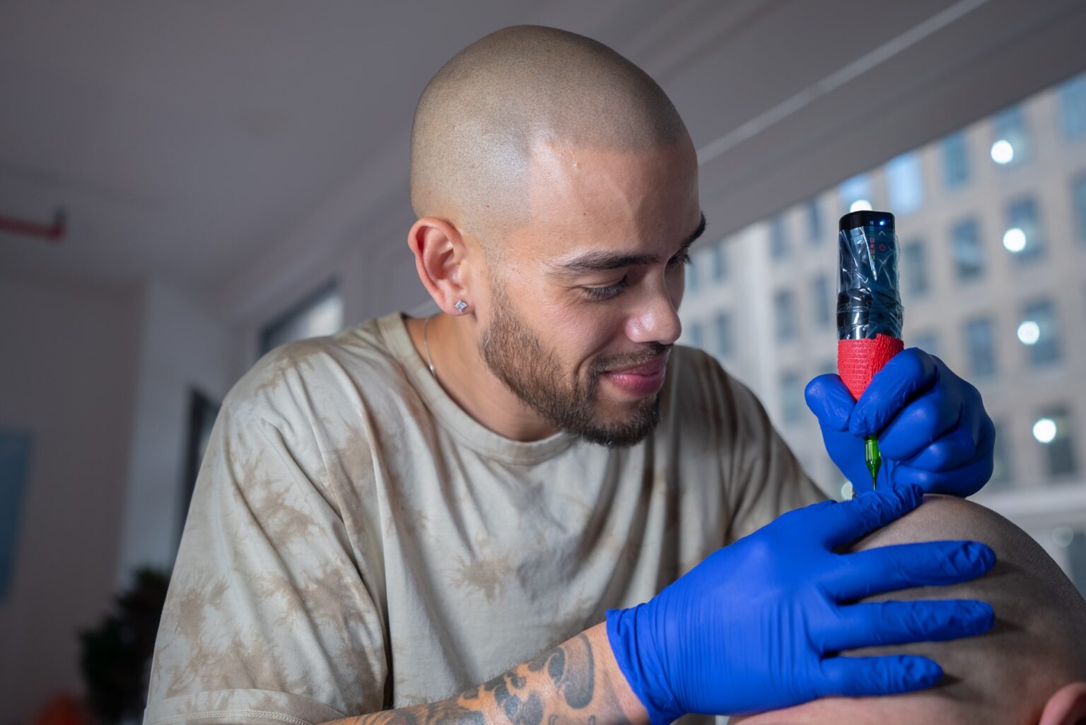 Mike Sosna Scalp Micropigmentation in Fort Lauderdale, Florida