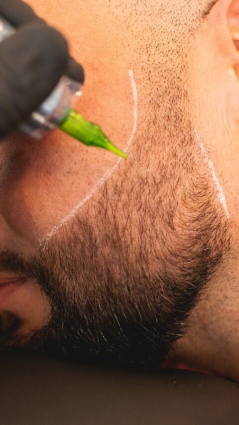beard micropigmentation smp