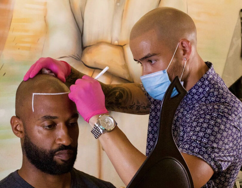 Scalp micropigmentation - Budapest