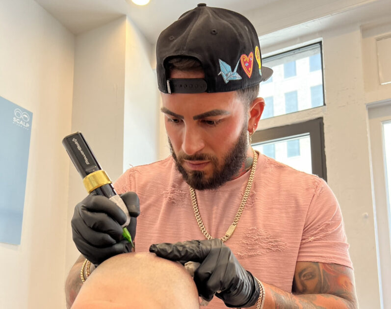 Scalpalex Scalp Micropigmentation