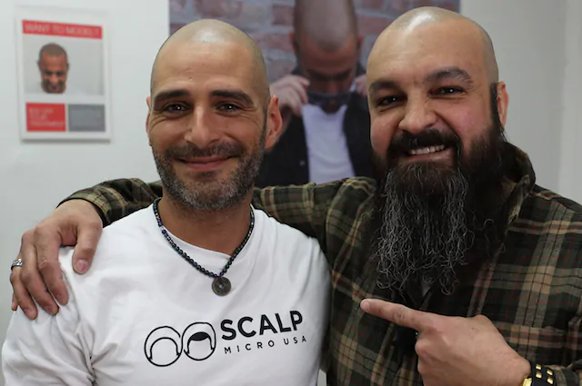 scalp micropigmentation nyc