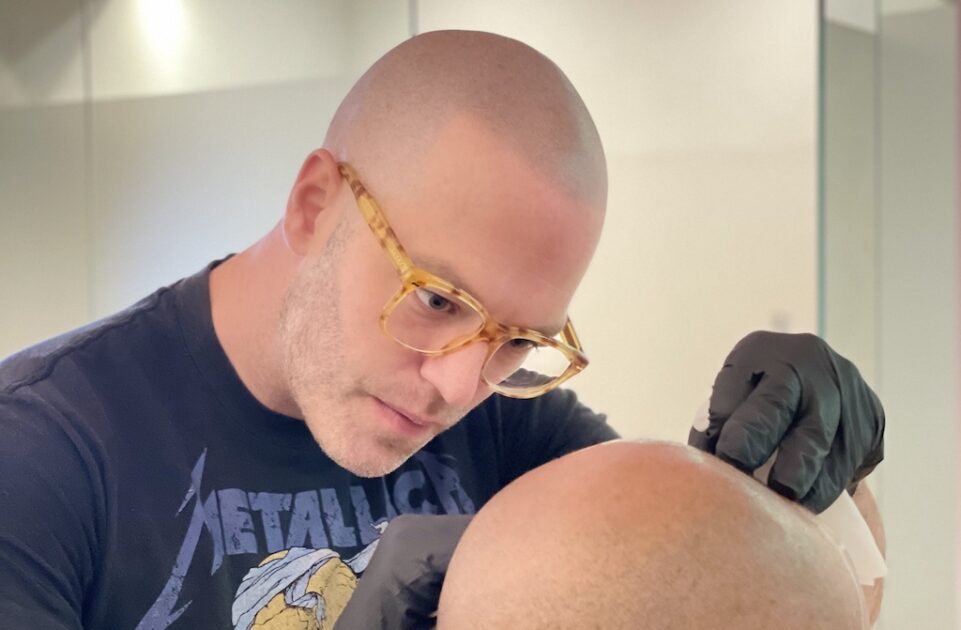 What is Scalp Micropigmentation and How Long Does it Last  Limmer HTC