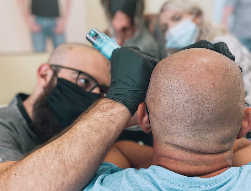 What is a hairline tattoo? - Scalp Micro USA