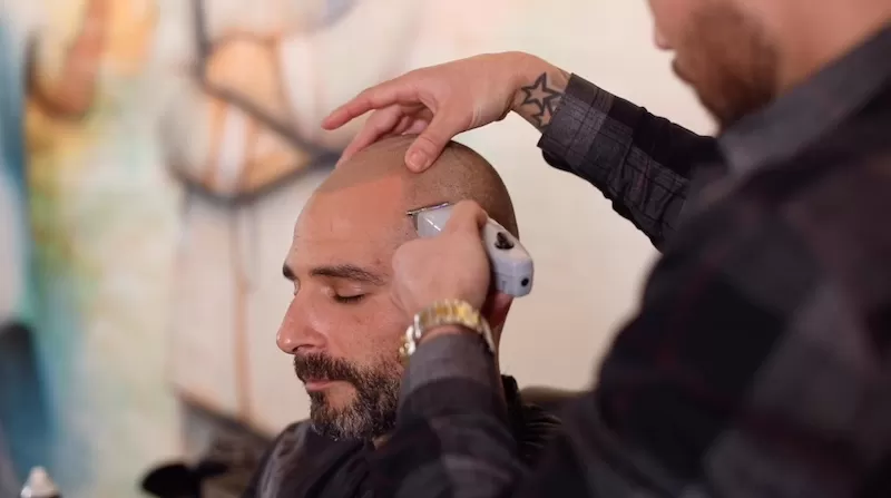 What are the hairstyle or haircut options for bald or balding men? - Quora
