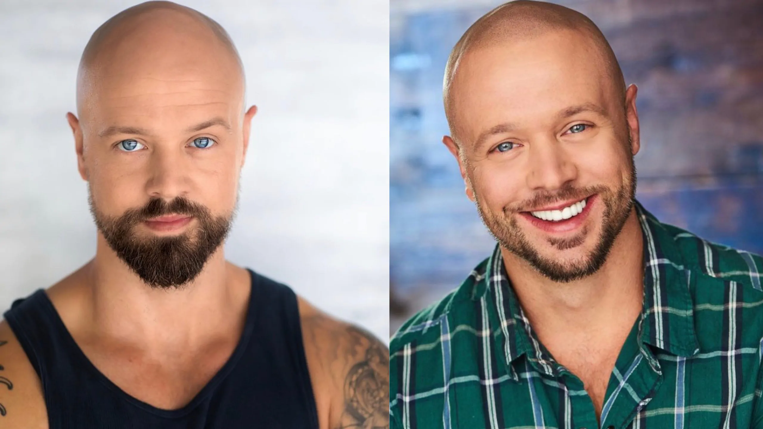 Hair Tattoos For Baldness | POPSUGAR Beauty